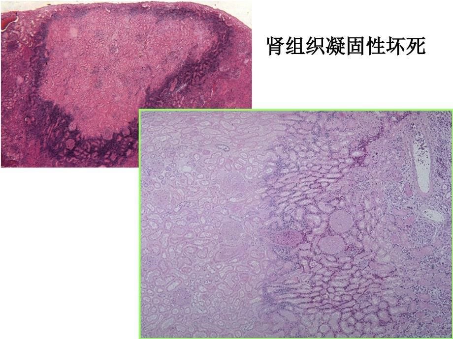 《病理切片复习》PPT课件_第5页