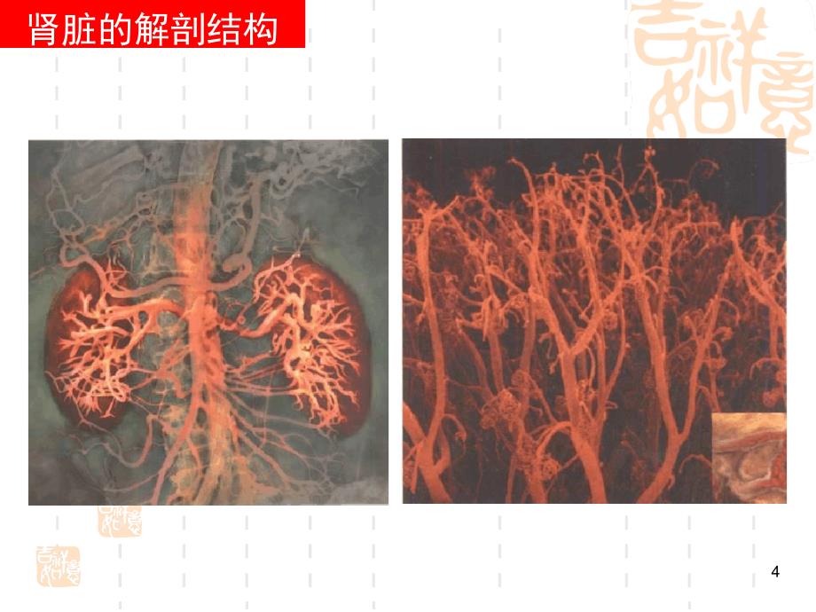 糖尿病肾病彭佑铭教授_第4页