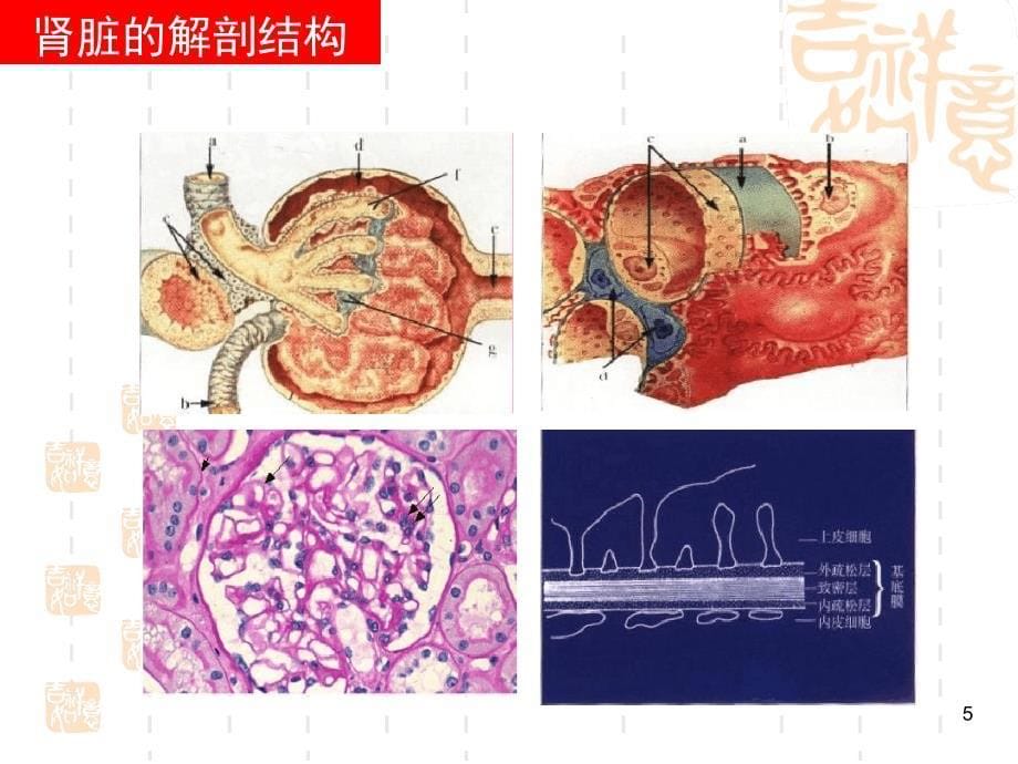 糖尿病肾病彭佑铭教授_第5页