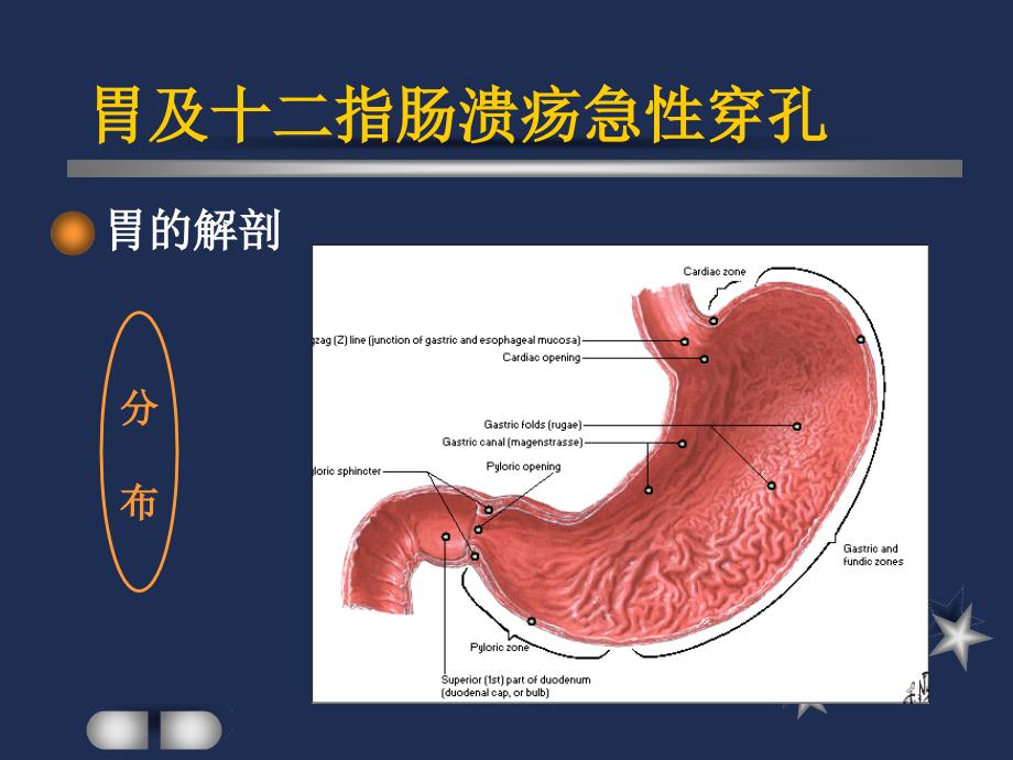 胃及十二指肠溃疡急性穿孔课件_第4页