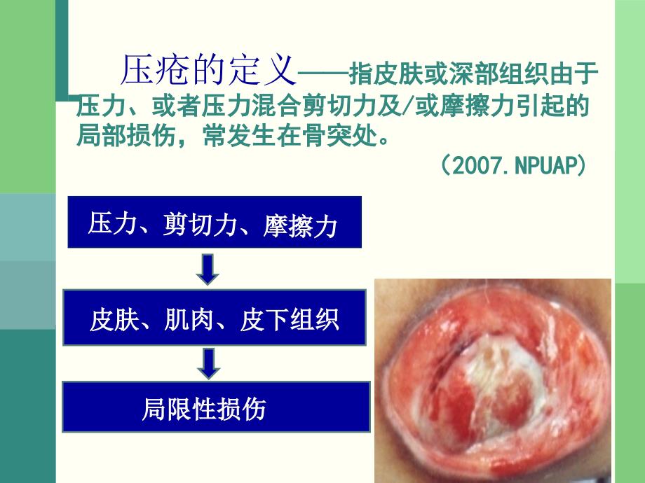 《压疮危险因素》PPT课件_第2页