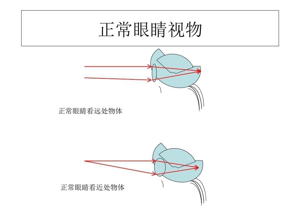 《眼睛与视力矫正》PPT课件_第5页