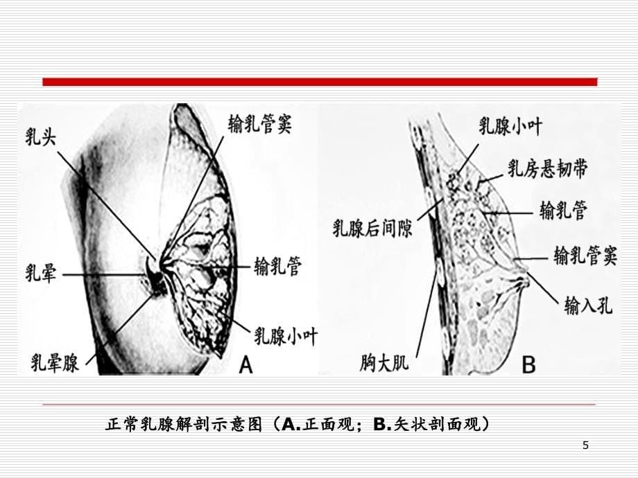 乳腺影像诊断.PPT_第5页