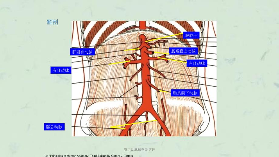 腹主动脉解剖及病理课件_第2页