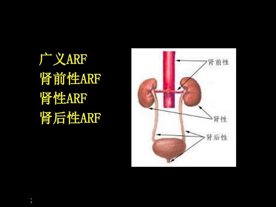 肾功能不全新版ppt课件_第5页