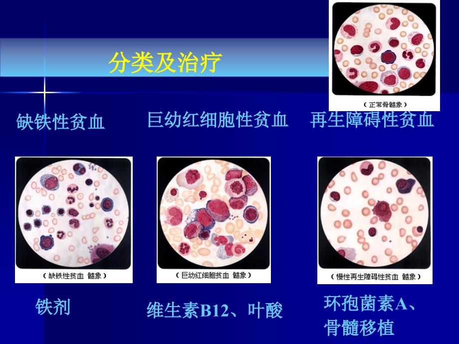 临床药理学第7章 血液系统疾病的临床用药_第3页