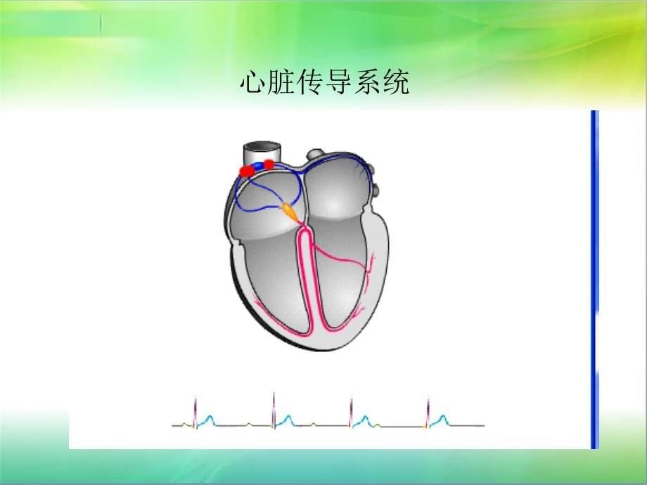 常见心律失常及处理_第5页