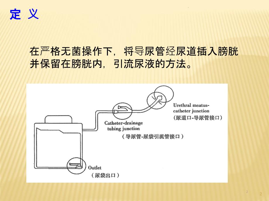 留置尿管漏尿原因分析及处理ppt课件_第2页