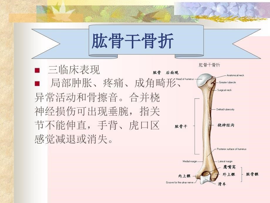 四肢骨折的护理PPT课件_第5页