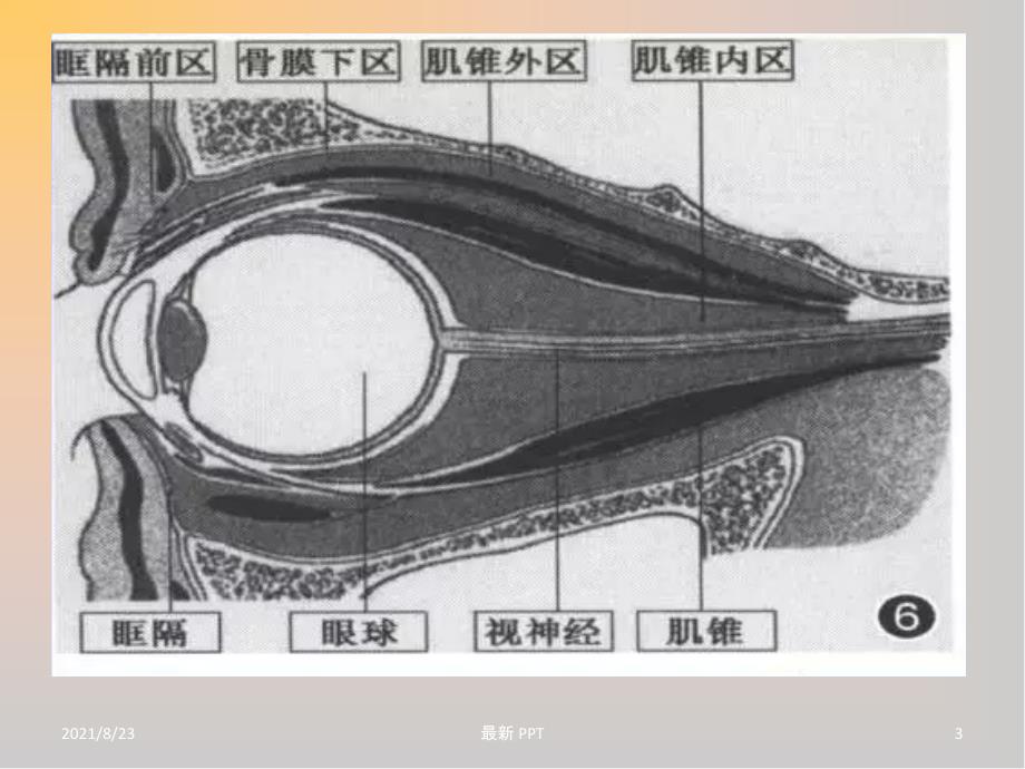 常见眼眶内肿瘤的影像诊断分析精品课件_第3页