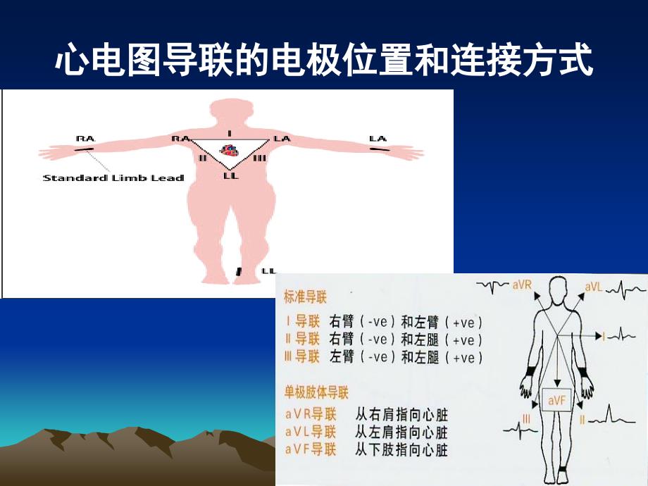 《心电图基本知识》PPT课件_第4页