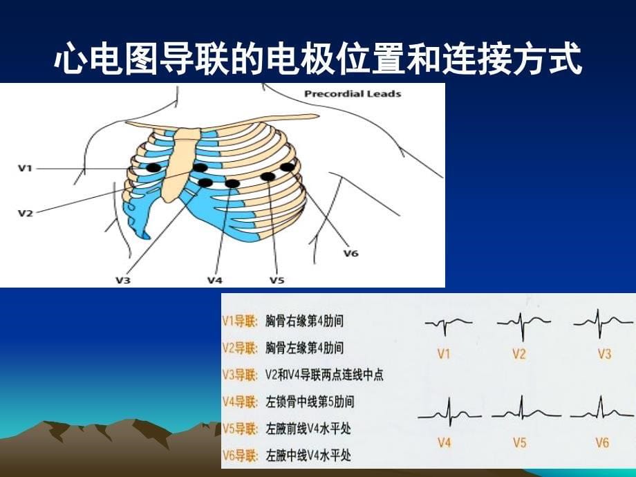 《心电图基本知识》PPT课件_第5页