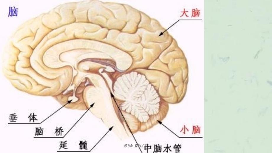 颅脑肿瘤的护理课件_第3页