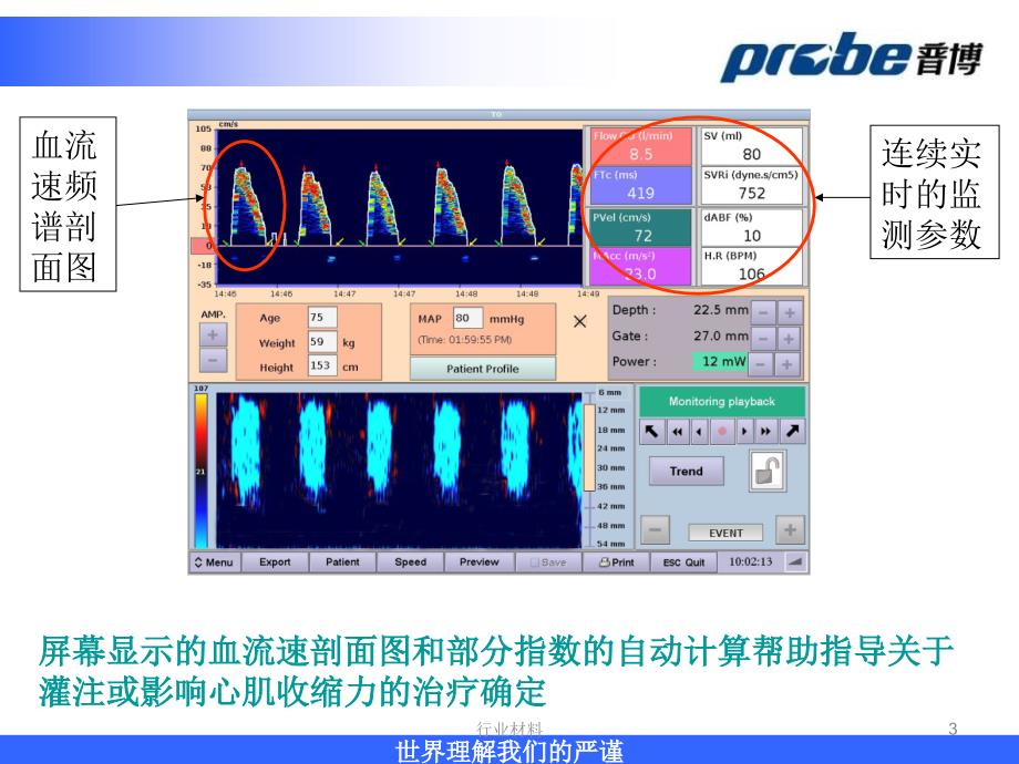 经食道多普勒无创血流动力学监护仪【行业知识】_第3页