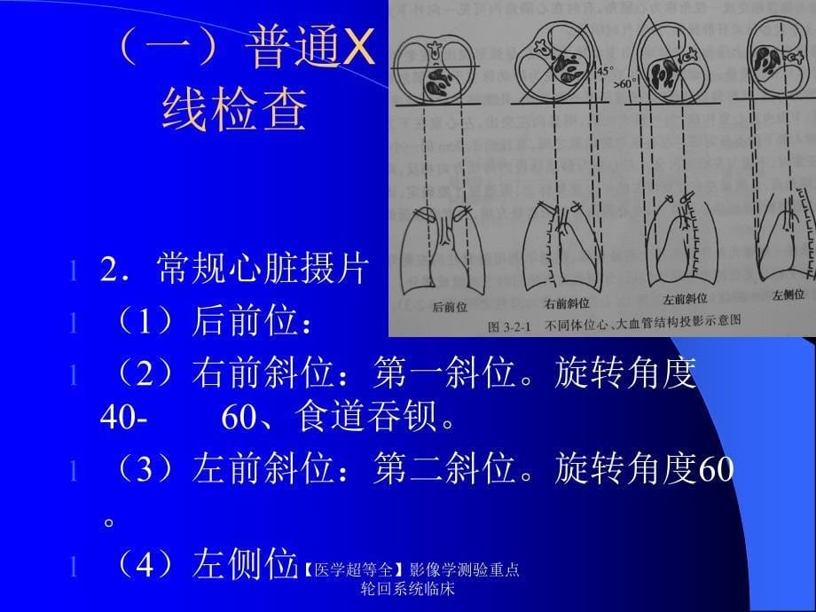 医学超等全影像学测验重点轮回系统临床课件_第5页