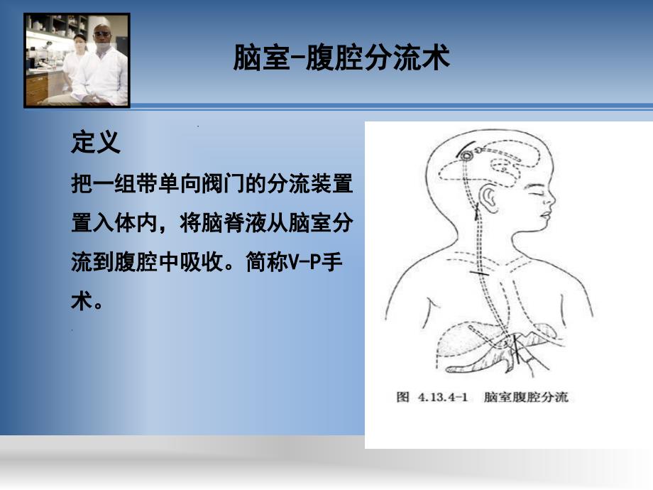 脑室腹腔分流术护理查房_第2页