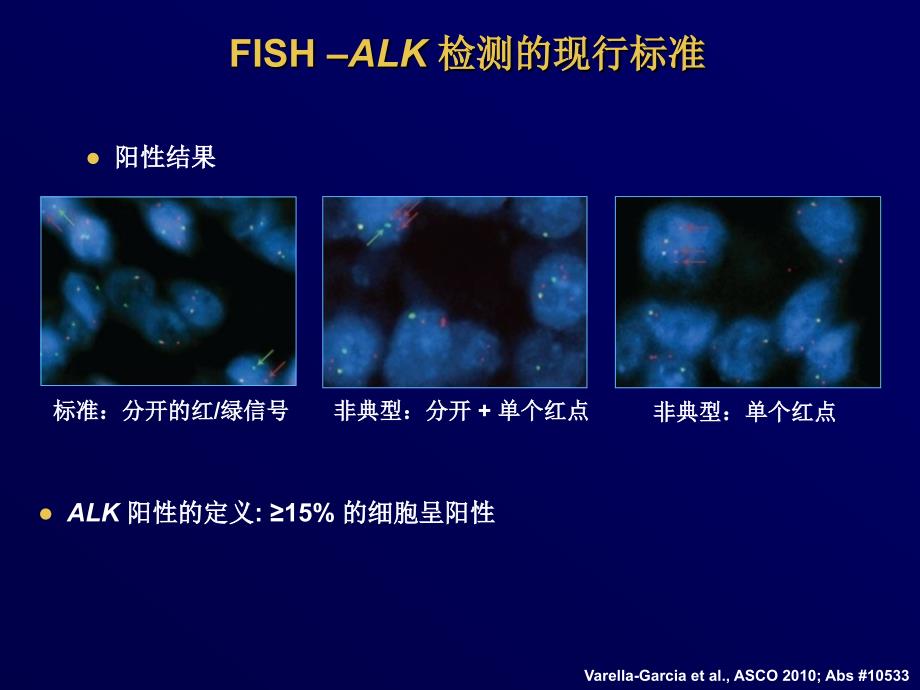 ALK的病理学和诊断指南_第2页