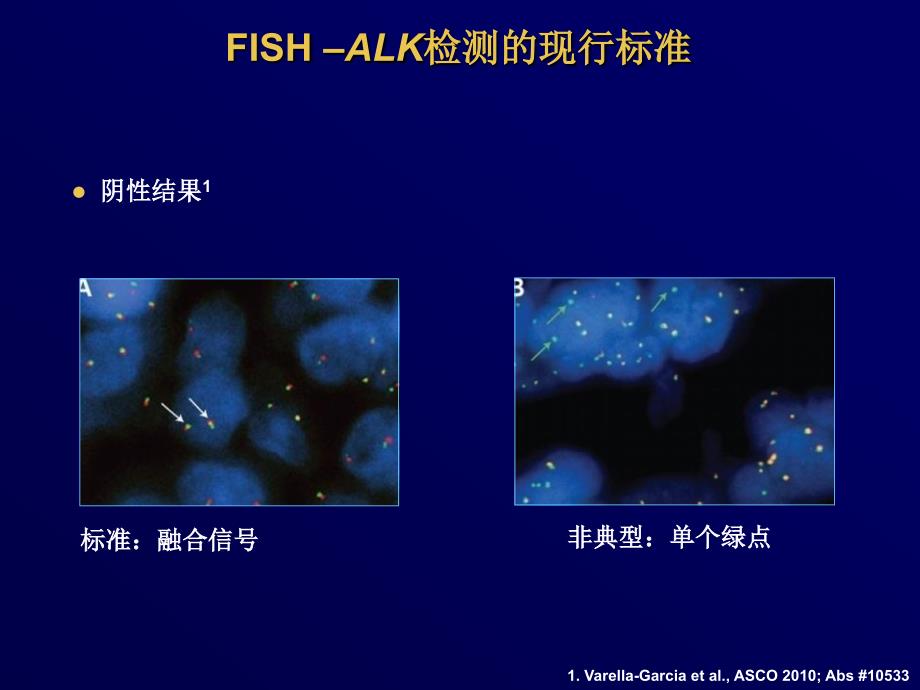 ALK的病理学和诊断指南_第3页