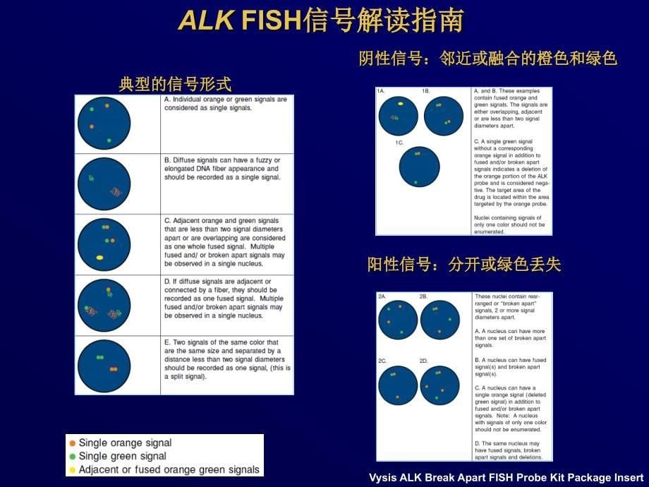 ALK的病理学和诊断指南_第5页