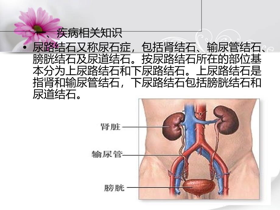 泌尿系结石健康教育课件.ppt_第2页