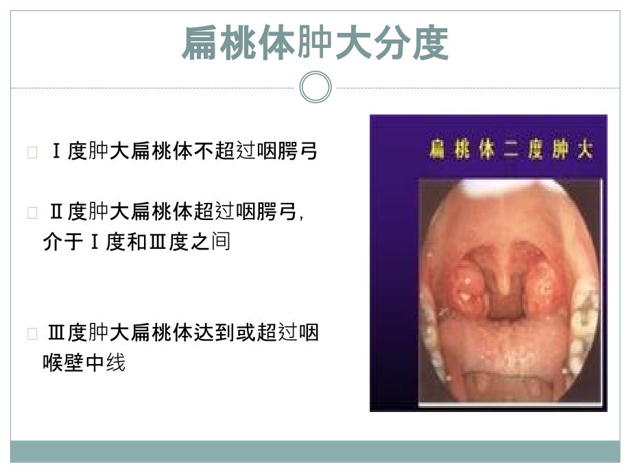 慢性扁桃体炎的护理查房_第4页