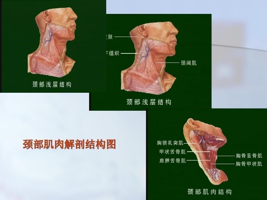 非常经典的甲状腺手术教学ppt课件_第5页