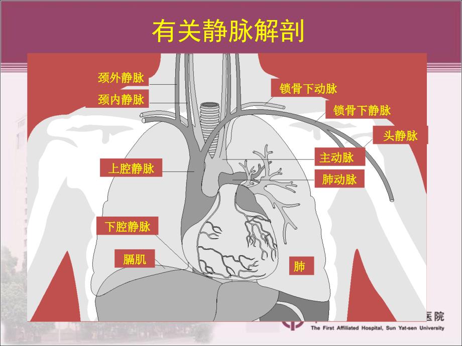 起搏器植入围手术期处理及注意事项---副本课件_第4页