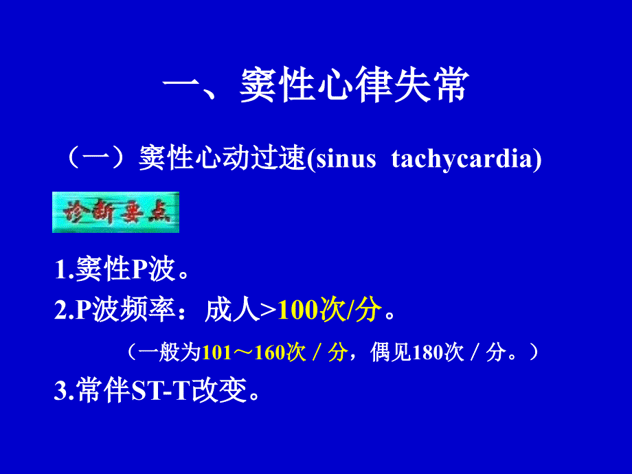 心律失常心电图表现_第3页