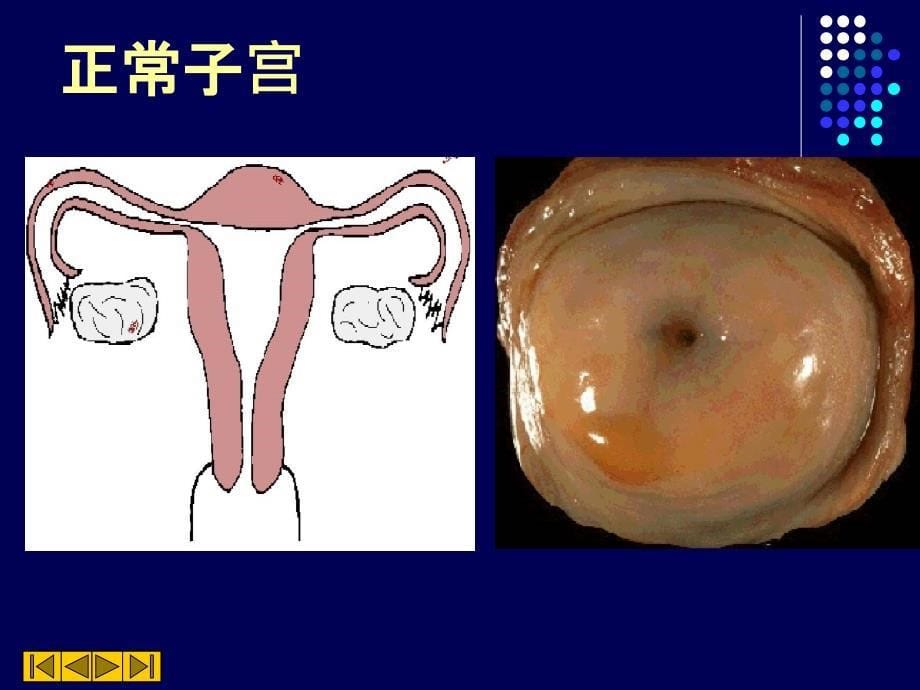 病理生殖系统疾病PPT_第5页