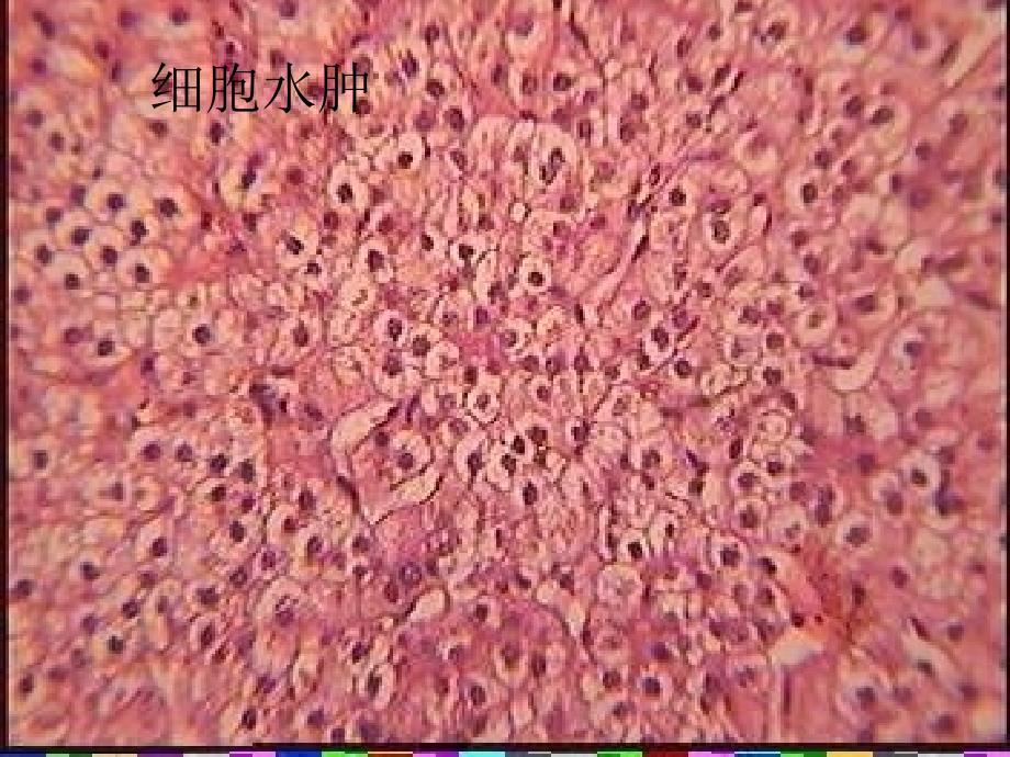 病理学图片2文档资料_第3页