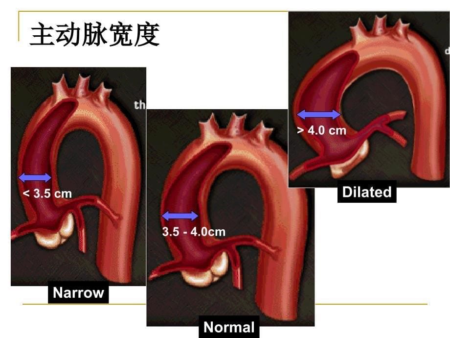 CTO病变介入治疗的器械选择_第5页