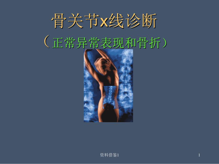 骨关节x线诊断-正常异常表现和骨折（行业荟萃）_第1页