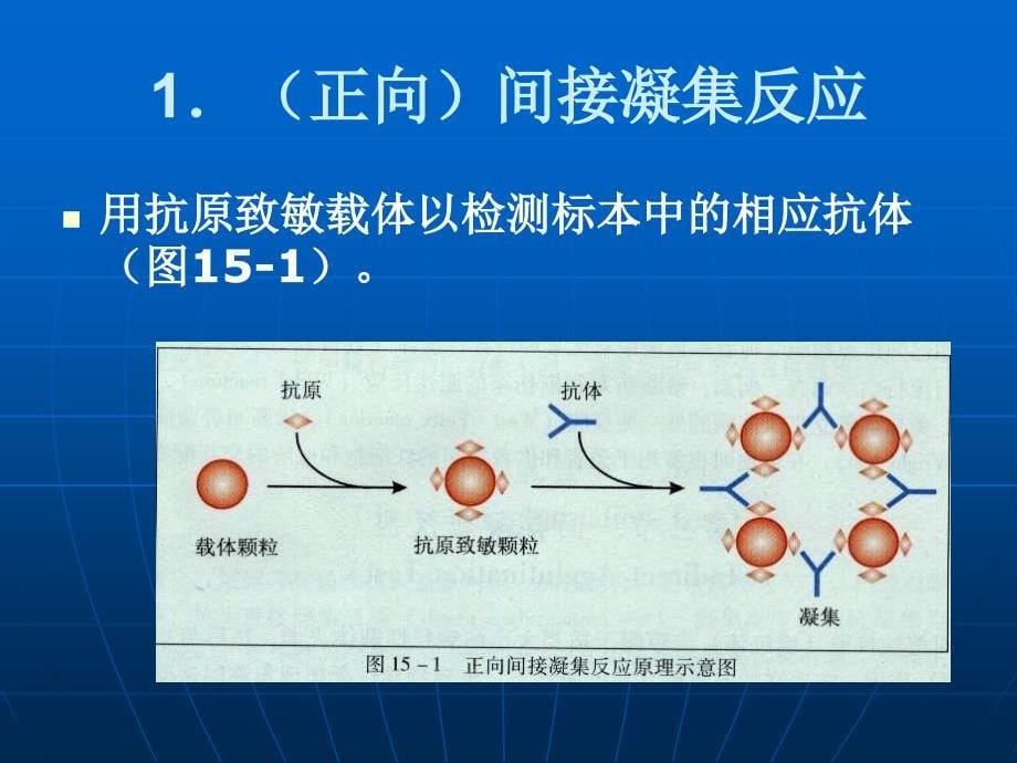 间接凝集反应_第5页