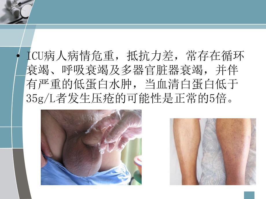 危重患者皮肤的护理.ppt_第4页