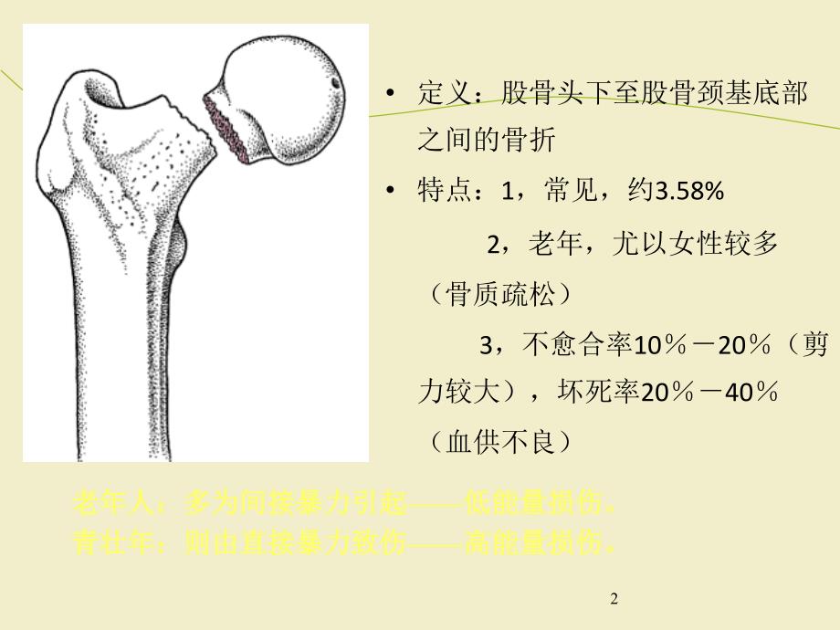 股骨颈骨折治疗选择ppt课件(1)_第2页