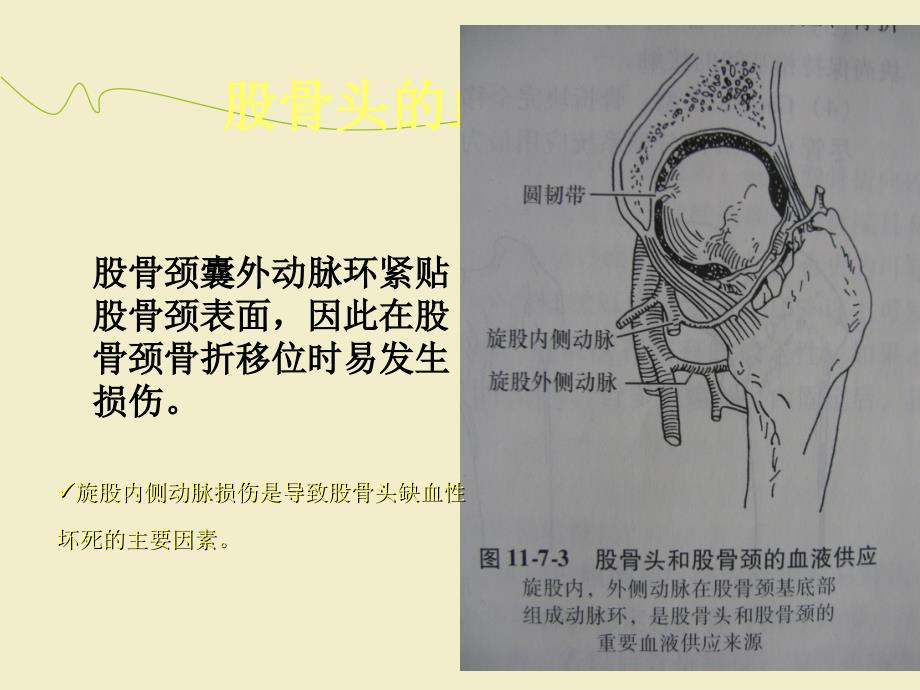 股骨颈骨折治疗选择ppt课件(1)_第4页