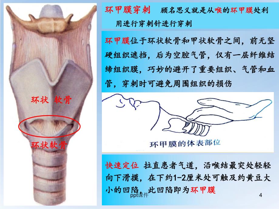 环甲膜穿刺课件_第4页