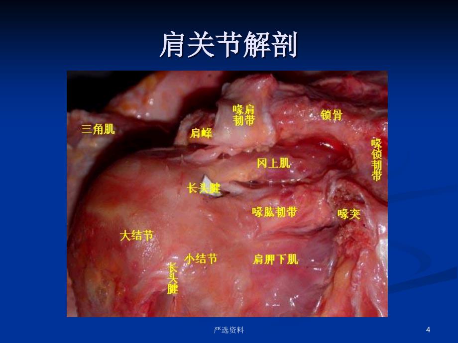 肩关节MRI-影像科（行业荟萃）_第4页