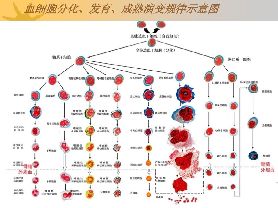 急性白血病-上交_第3页