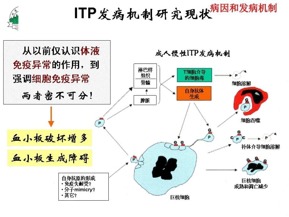 特发性血小板减少性紫癜-第八版课件_第5页