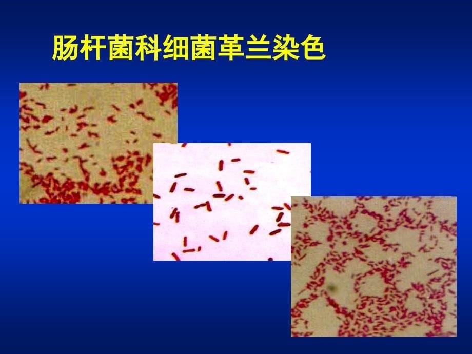 微生物学第10章肠杆菌属_第5页