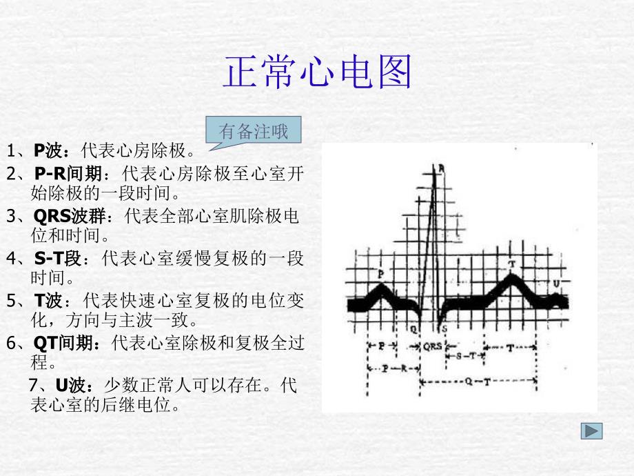 心电监护仪操作ppt课件_第4页