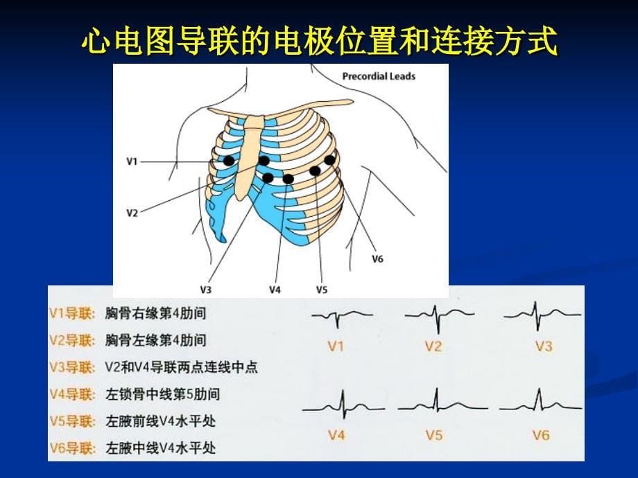 心电监护仪操作ppt课件_第5页