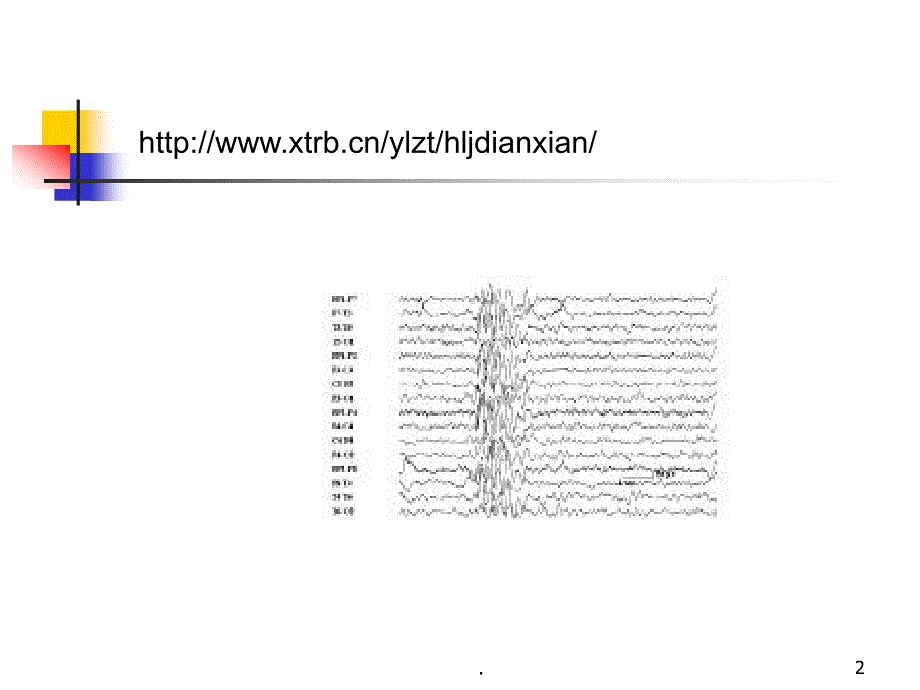 癫痫精品ppt医学课件_第2页