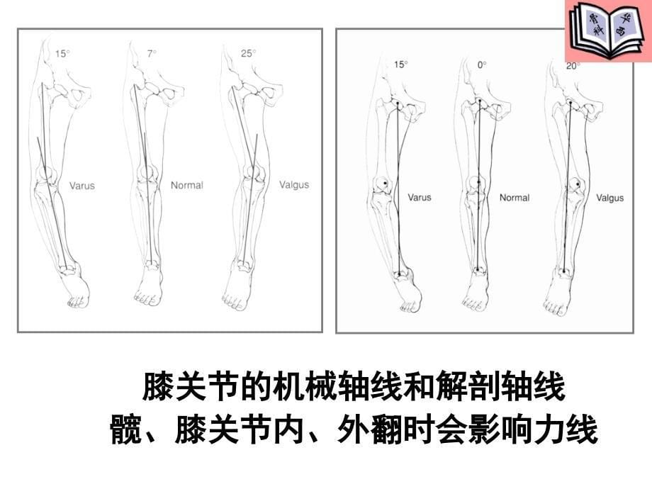 全膝关节置换的手术原则课件_第5页