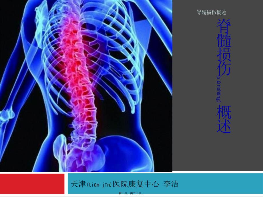 脊髓损伤概述课件_第1页