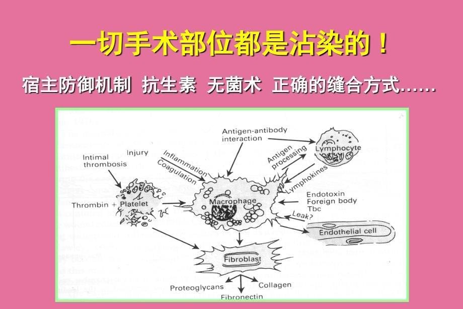 骨与关节感染邱贵兴教学幻灯ppt课件_第5页