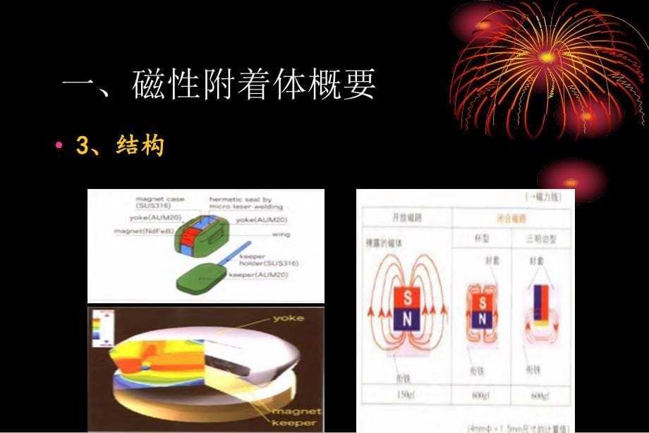 磁性附着体覆盖义齿的临床术式_第5页