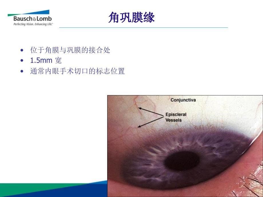 眼科超乳玻切手术基础知识_第5页