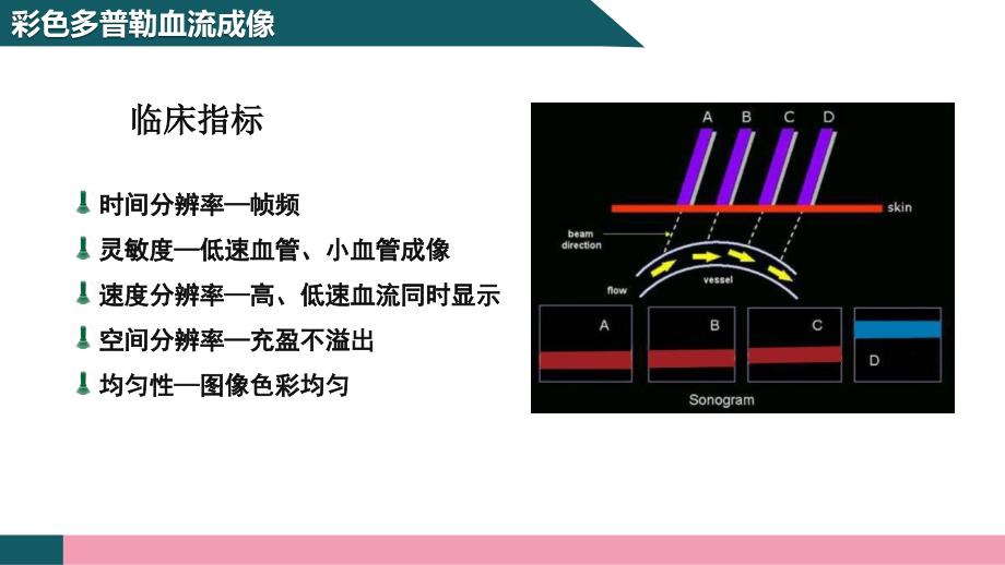 彩色多普勒超声成像原理_第3页